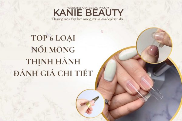nối móng thịnh hành
